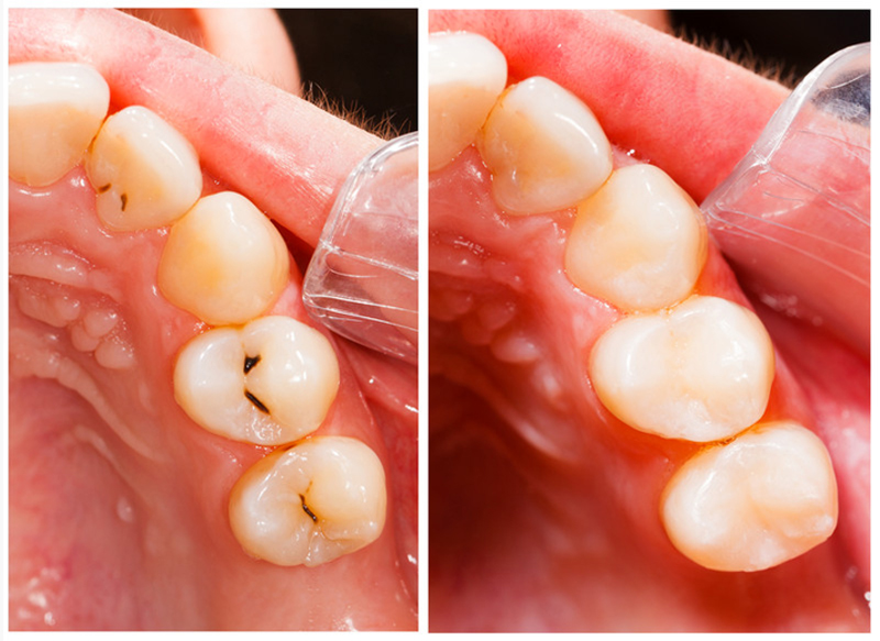 Fillings service imagery